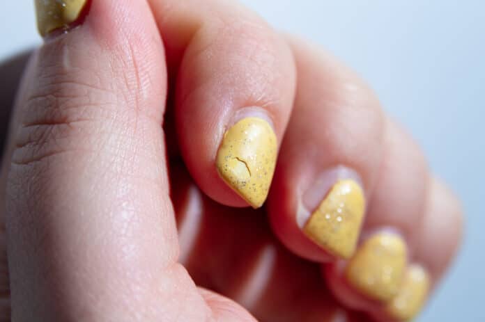 Index,Finger,With,A,Damaged,Yellow,Gel,Polish,Coating.,Selective
