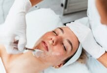 La Photothermie Micro-Ciblée Épidermique (PMCE) : Une Révolution pour Traiter l’Acné Adulte